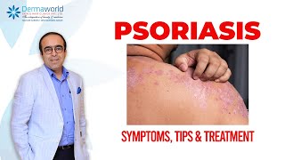 Psoriasis  Symptoms Tips and Treatment  The Best Psoriasis Treatment in Delhi  Dr Rohit Batra [upl. by Caitrin]