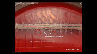 Satellitism test [upl. by Alonso]