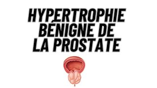 Hypertrophie bénigne de la prostate [upl. by Dronski]