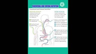 Parenteral nutrition and Enteral nutrition nursingnotes [upl. by Ogram]