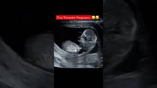 First Trimester Pregnancy [upl. by Ytsihc193]