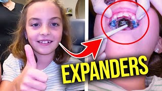 Getting a Palatal ExpanderHow expanders work  McKinney Orthodontist [upl. by Eiltan]