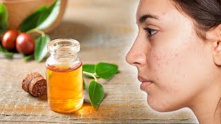 5 Benefits of Using Jojoba Oil For Your Face and Skin [upl. by Scoles]