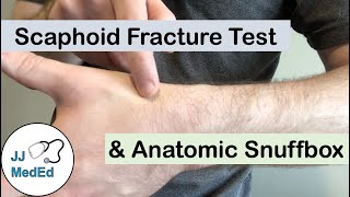 Scaphoid Fracture Test Clinical Exam and the Anatomic Snuffbox [upl. by Marlon]