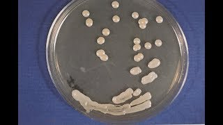 Cryptococcosis  Opportunistic Mycoses 1 S0125 Microbiology MCQs [upl. by Karlene379]