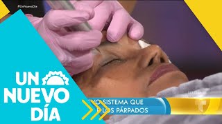 Fibroblast el tratamiento que te rejuvenece sin cirugías  Un Nuevo Día  Telemundo [upl. by Porche129]