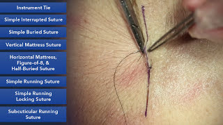 Learn How To Suture  Best Suture Techniques and Training [upl. by Cutler57]