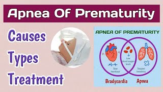 Apnea Of Prematurity  Apnea In Premature Babies  Breathing Problems In Newborns [upl. by Ocirred]