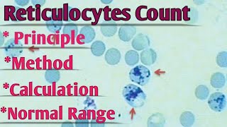 Reticulocyte Count  Staining Principle Method Calculation  Normal Range Interpretation [upl. by Novia]