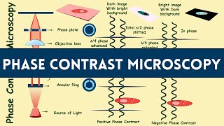 Phase contrast microscopy  phase contrast microscope  phase contrast microscopy in Hindi  Urdu [upl. by Delanty]