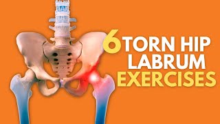 Top 6 Exercises For Naturally Healing A Painful Torn Hip Labrum [upl. by Libbna]