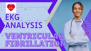 EKG Analysis Ventricular Fibrillation VFib [upl. by Morgen]