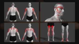 trigger point uitleg animatie Dutch [upl. by Aidan]