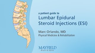 Lumbar Epidural Steroid Injections [upl. by Miksen]