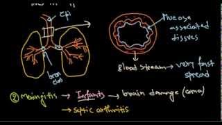 Haemophilus influenzae infection [upl. by Reinar119]