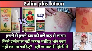 Zalim plus lotion use dose benefits and Side effects full review in hindi [upl. by Sackey]