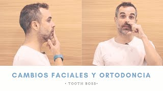 TOOTH BOSS  ¿La ORTODONCIA puede cambiarme la CARA 😱 Ortodoncia en Murcia [upl. by Eromle]