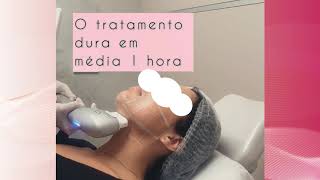 DRA EXISTE LIPOASPIRAÇÃO DE PAPADA SEM CIRURGIA [upl. by Killy]