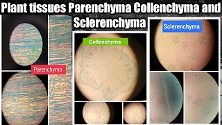 Plant tissues Parenchyma Collenchyma and Sclerenchyma observation under microscope 🔬 [upl. by Jeddy]