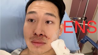 Septoplasty and Turbinate Reduction 2 Month Recovery and Review [upl. by Slaby]