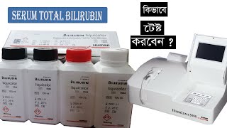 Total Bilirubin Test procedure ।। কিভাবে Total Bilirubin Test করবেন [upl. by Yeh]