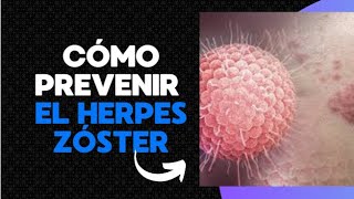 quotCómo prevenir el Herpes Zóster y evitar el dolor crónicoquot [upl. by Mcgregor]