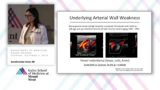 Cervical Artery Dissection New Insights amp Continued Controversies [upl. by Niasuh]