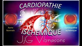 CARDIOPATHIE ISCHÉMIQUE  Non transmissible mais la plus mortelle dans le monde  432 Hz entre autre [upl. by Nnylireg488]