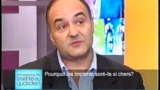 Pourquoi les implants dentaires sontils si chers [upl. by Eniamsaj3]