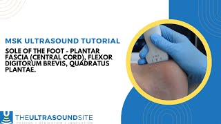 MSK ultrasound of the plantar foot [upl. by Brause226]