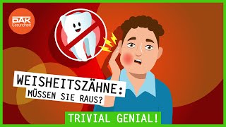 Weisheitszähne Müssen sie raus  trivialgenial  DAKGesundheit [upl. by Mylo413]