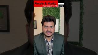 Sirf 1 Homeopathic Medicine For Pimples amp Marks in face  How to Use drkirtivikram shorts [upl. by Eicart702]