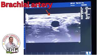 Arterial pulsation examination importatnt Tip Dr Alaa Nasr 2024 [upl. by Ainevuol960]