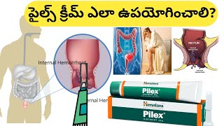 How to Use Piles Ointment in Telugu [upl. by Kinsler198]