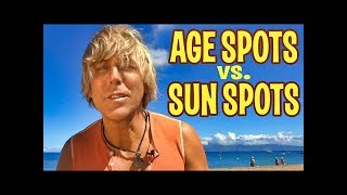 AGE SPOTS or SUN SPOTS on Skin How to Get Rid of Them [upl. by Nance814]