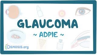 Glaucoma Nursing Process [upl. by Sochor]