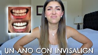 Un año con Invisalign  Mi experiencia  Costo  Fotos del Proceso 🙃 [upl. by Nattirb]