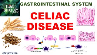 Celiac disease Etiopathogenesis Morphology amp Clinical features GIPath ilovepathology [upl. by Kryska]