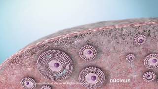 Understanding Ovarian Cancer [upl. by Desmund]