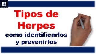 Tipos de Herpes como identificarlos y prevenirlos [upl. by Eimerej933]