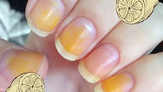 How to remove stains from your nails attempt 1  lemons and baking soda does it work [upl. by Edana]