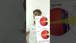 Presbyopia bio phys sciencefun experiment [upl. by Horick]