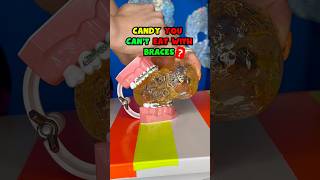 DEFINITELY AVOID this CANDY with BRACES ORTHODONIST REACTS 👀 braces candy crunchy [upl. by Madriene]