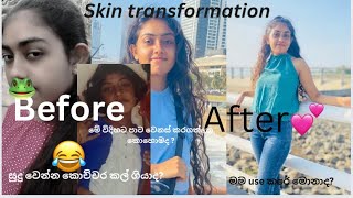 මෙහෙම පාට වෙනස් කරගත්තෙ කොහොමද 😂💔skin transformation අඩු වියදමින් මම colour එක වැඩිකරගත්තාviral [upl. by Adnalay]