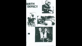 VA  Birth Defect Compilation Tape 1983 [upl. by Nosahc]