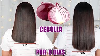 RETO3 CEBOLLA PARA HACER CRECER EL CABELLO Y DETENER LA CAIDA EN 8 DIAS 🧅 [upl. by Chilson]