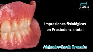 Impresiones Fisiológicas en Prostodoncia Total Alejandro García Armenta [upl. by Neevan379]