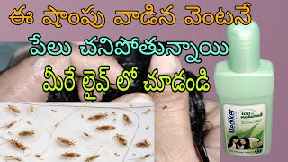 తలలో పేలు పోవడానికి సూపర్ షాంపూ  how to use mediker shampoo in telugu  lice removal shampoo [upl. by Salzhauer632]