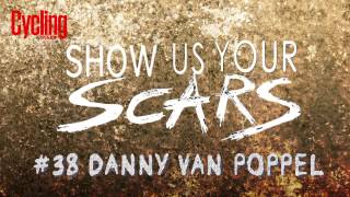 Show us your scars 38 Danny van Poppel [upl. by Ellehcsor]