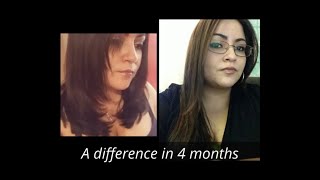 Biotin 5000 mcg results before and after [upl. by Etteiluj]